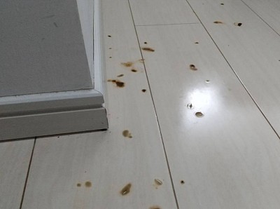 写真のような目立つタバコの焦げあと、お灸の焦げつき、フローリング補修いたします。